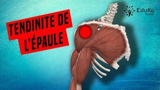 COMPRENDRE LA TENDINITE DE L'ÉPAULE [Explications professionelles]