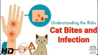 Risks Cat Bites and Infection: What Happens If You're Bitten?