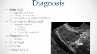 Ectopic Pregnancy - USMLE Step 2 Review