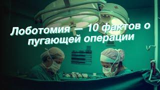 Лоботомия — 10 фактов о пугающей операции