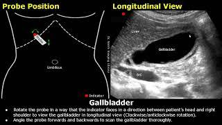 Gallbladder Ultrasound Probe Positioning | Transducer Placement & Scanning | Abdominal USG