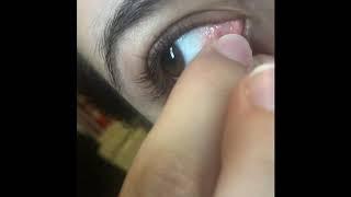 Eye Mucus from Makeup Removal