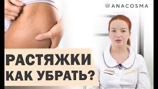 ️Как убрать растяжки и стрии?️️ ТОП-процедур