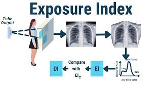 Exposure Index (DEI, EI, REX) , Deviation Index (DI)