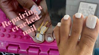 How to Repair a crack in your nail | Toe Nail repair | Easy Fix