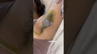 Satisfying underarm waxing results #underarmwaxing #eyebrows #waxing #shorts #winnipeg #viral