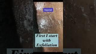 How I Do My Vajacial At Home-No More Hyperpigmentation and Ingrown hairs