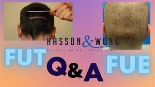 FUT or FUE Hair Transplant? *Q&A Hasson and Wong