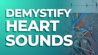 S1, S2, S3, and S4 Heart Sounds | MedStudy's Heart Sounds