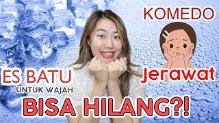 ES BATU UNTUK WAJAH?! | BENER GA SIH BISA HILANGIN KOMEDO DAN JERAWAT