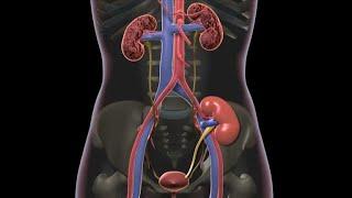 What Is a Kidney Transplant?