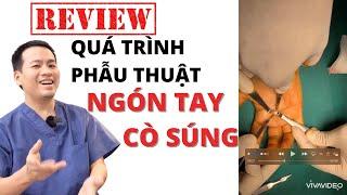 [REVIEW] quá trình mổ ngón tay cò súng (Ngón tay lò xo) 2021 - 0898313122 (sms/zalo)