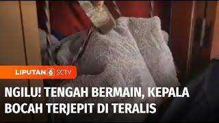 Ngilu! Kepala Bocah Terjepit di Teralis Saat Bermain | Liputan 6