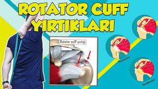 Omuz Kas Yırtığı /  Rotator Manşet Yırtığı Sendromu / Omuz Yırtık Egzersizleri