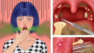 ASMR animation｜Pretty girl cleaning tonsil stones｜clean the tongue