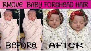 How To Remove Newborn Baby Face Hair / Remove Unwanted Baby's Hair