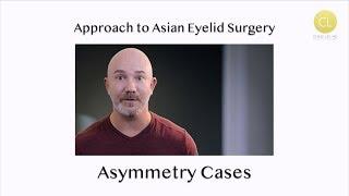 Approach to Asian Eyelid Surgery: Asymmetry Cases with Chase Lay MD