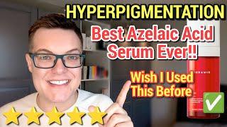 BEST AZELAIC ACID SERUM EVER - Fade Hyperpigmentation Fast