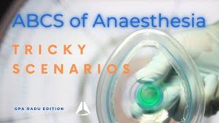 Tricky Anaesthesia Problems