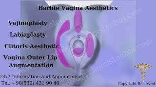 What is Barbie Vagina Aesthetics? How to do Barbie Vagina Aesthetics?
