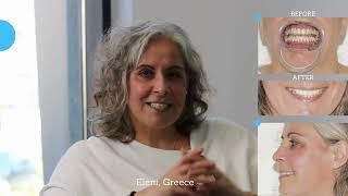 Eleni from Greece shares her experience @dental-implants