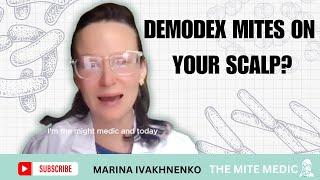 DEMODEX MITES ON MY SCALP? TREATMENT, SYMPTOMS, ROOT CAUSES