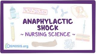 Anaphylactic shock: Clinical Nursing Care