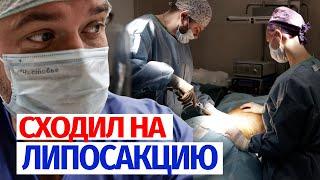 ЛИПОСАКЦИЯ: Самая большая по смертности операция в пластической хирургии