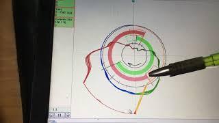 Фазовращатели влияние на работу двигателя Aveo, проверка фаз грм F14d4.