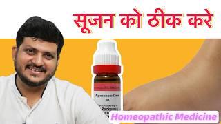 Apocynum Homeopathic Medicine | Symptoms | How to Use | Oedema | swollen feet | foot swelling