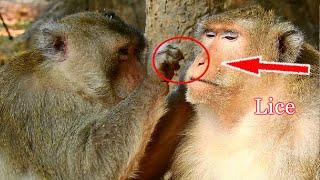 Billion Cutest Big Aseop Monkey Come to Finding Lice And Grooming For Big King Mak