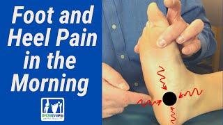 Plantar Fasciitis and Morning Foot Pain.