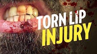 Quick torn lip injury SFX makeup tutorial