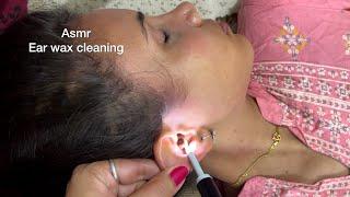 ASMR the best ear cleaning and ear massage/Ear Wax cleaning pt2