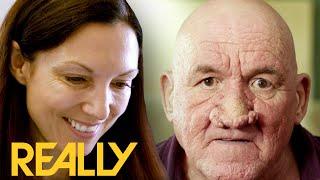 Dr Emma Helps Actor With a Big And Bulbous Nose Who Is Struggling To Book Jobs | The Bad Skin Clinic