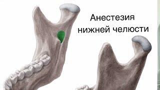 Мандибулярная анестезия. Анестезия нижней челюсти