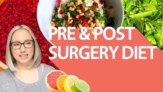 Pre and Post Surgery Diet -  Healing foods to prepare you for surgery and recovery