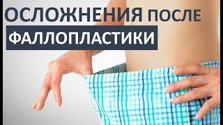 ОСТОРОЖНО! Осложнения после увеличения члена!