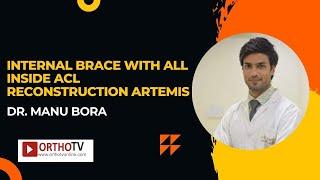 Internal Brace with All Inside ACL Reconstruction ARTEMIS - Dr. Manu Bora