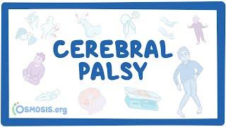 Cerebral palsy (CP) - causes, symptoms, diagnosis, treatment, pathology