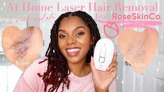 Brown Skin At Home Laser Hair Removal + 6 Week Update ft. Lumi RoseSkinCo. || Glow Like a Goddess!