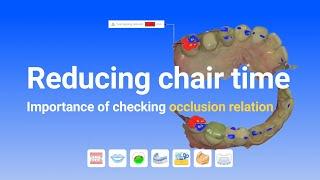 Reducing chair time : Importance of checking occlusion relation