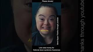 Down syndrome does not define you#shorts#short#youtubeshorts #fyp#tiktok#trending#downsyndrome