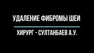 Удаление фибромы шейной области в Уфе