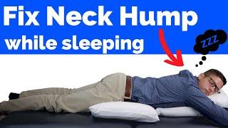 How to Fix Neck Hump While Sleeping