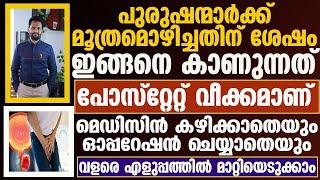 പ്രോസ്റ്റേറ്റ് വീക്കംമെഡിസിൻ കഴിക്കാതെയുംഓപ്പറേഷൻ ചെയ്യാതെയും വളരെ എളുപ്പത്തിൽ മാറ്റിയെടുക്കാം|