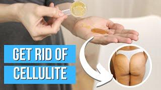 GET RID OF CELLULITE 3 natural ways