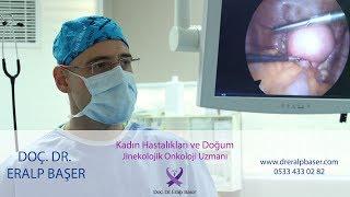 Endometrium (rahim) kanseri hakkında sık sorulan sorular - Doç. Dr. Eralp Başer