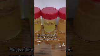 Urine color variation #urine #urinalysis #urochrome #laboratory #medtech #hydrated #dehydrated #mls