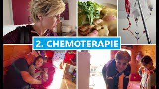 2. CHEMOTETRAPIE, PARUKA | MamaVlog#649 | Máma v Německu